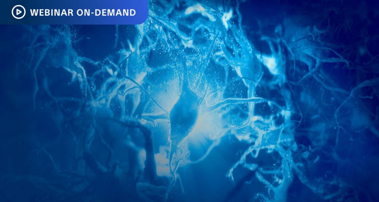 Webinar-On-Demand: Stylized illustration of neural activity.