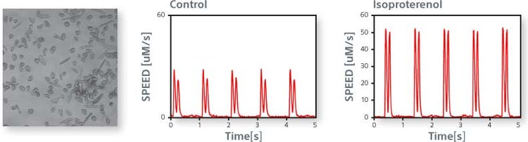 The image on the left shows isolated primary ventricular cardiomyocytes. The beat profile is obtained under control conditions (center) and in response to Isoproterenol (right)