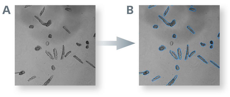 Easily detect markers of arrhythmia