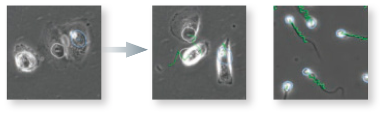 Easily detect markers of arrhythmia