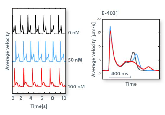 Easily detect markers of arrhythmia