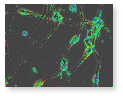 Easily detect markers of arrhythmia