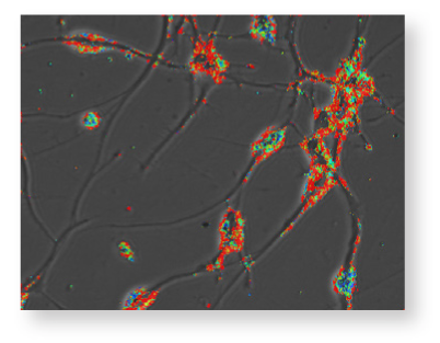 Easily detect markers of arrhythmia