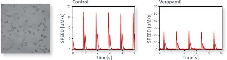 The image on the left shows isolated primary ventricular cardiomyocytes. The beat profile is obtained under control conditions (center) and in response to Verapamil (right).