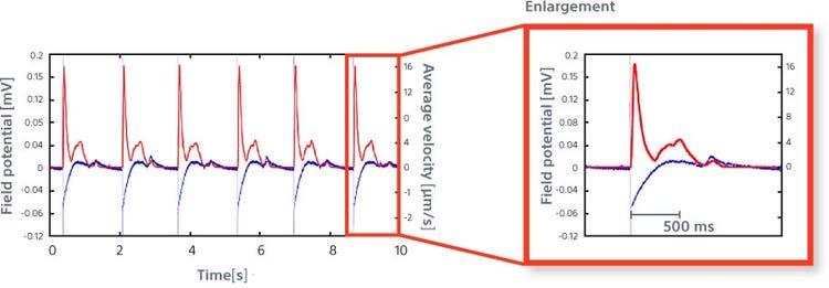 Quantification of cardiomyocytes contractility
