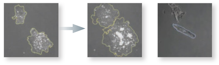 Easily detect markers of arrhythmia