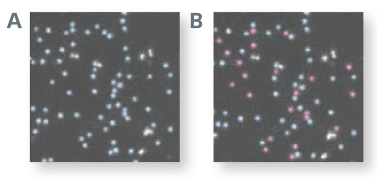 Easily detect markers of arrhythmia