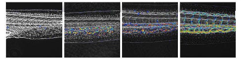 The four images represent the speed of blood flow in four stages of Zebra Fish larvae development.