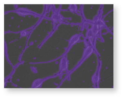 Easily detect markers of arrhythmia
