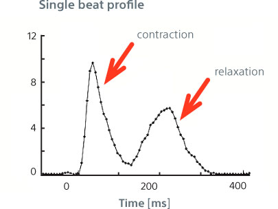 Quantification of cardiomyocytes contractility