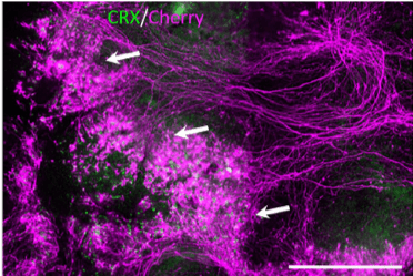 Retinal organization by hPSC derived retinal ganglion cells.